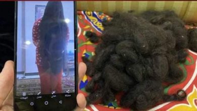 صورة استهتار عاملة بمحل كوافير يحرق شعر «روان» ويصيبها بـ«الصلع»!!