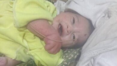 صورة جريمة صامتة.. وضحية بلا ذنب !!